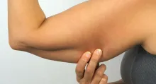 Conozca cuál es el ejercicio que se tiene que hacer para adelgazar los brazos y tonificarlos y la razón por la que acumula grasa en las extremidades.