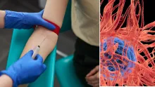 La prueba Mced puede identificar señales químicas de esta enfermedad. Los hallazgos se publicaron en 'BMJ Open'.