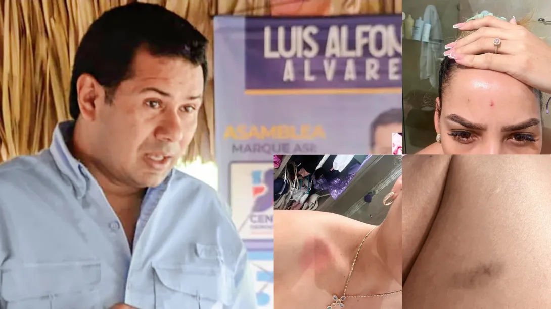 Luis Alfonso Álvarez fue elegido en 2023 para la Asamblea Departamental de Sucre con cerca de 16.000 votos. Recibió el aval del Centro Democrático.